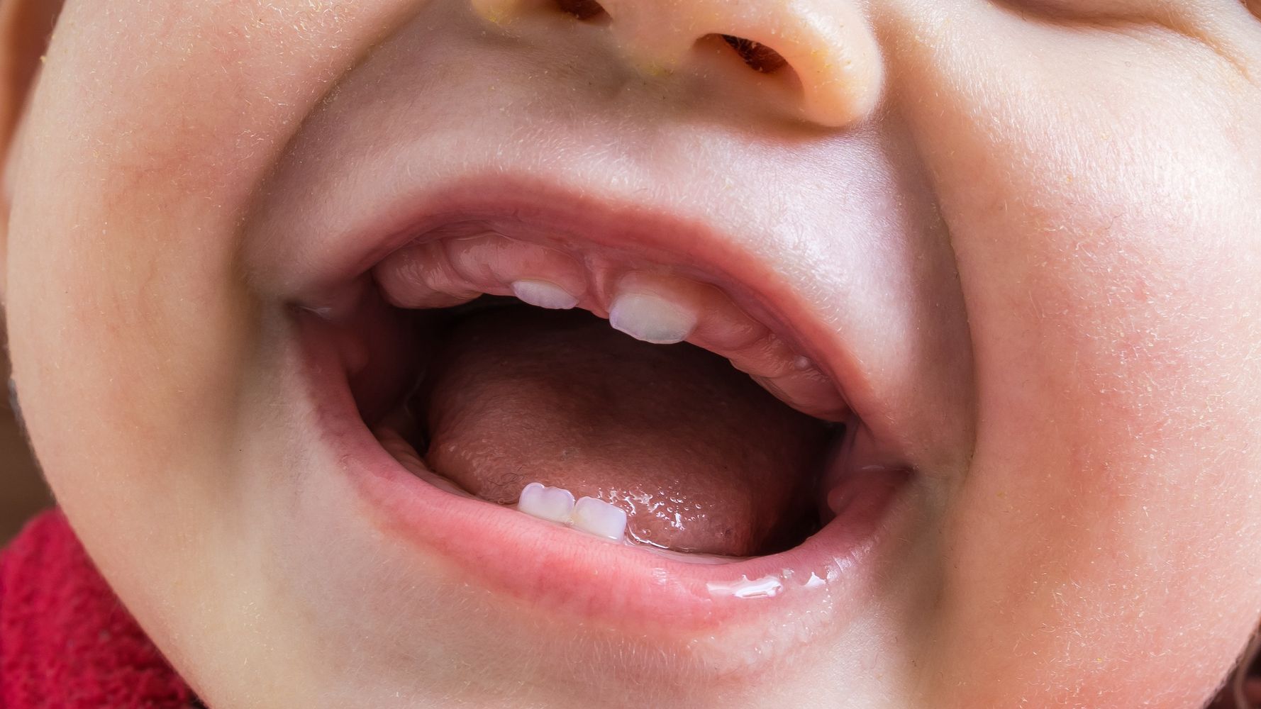 A 12-Day-Old Baby Had To Have A Tooth Removed | HuffPost UK Parents