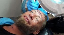 Homeless Man Paid To Have Forehead Tattooed Did So 'Out Of Desperation'