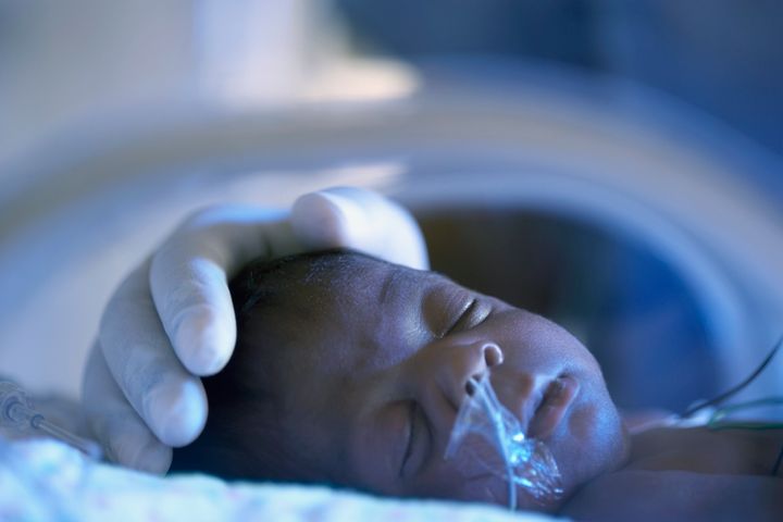 California was the only state to significantly reduce the rate of stillbirths and newborn deaths from 2014 to 2016.