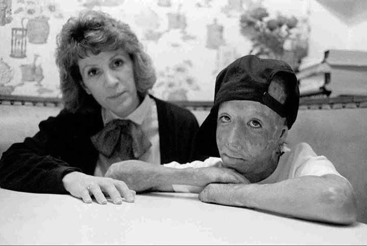 Dave Dave, right, was set on fire by his father in an Orange County, California hotel room in 1983. He appears in this file photo with his mother, Marie Rothenberg.