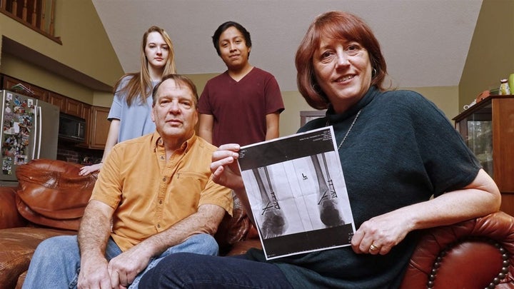 Leslie Kurtz, right, of Knoxville, Tennessee, relied on coverage she purchased through an Affordable Care Act health care exchange when she broke every bone in her ankle in a whitewater rafting accident. Premiums in Tennessee are expected to fall this year.