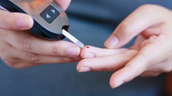 Diabetes, Amputation,