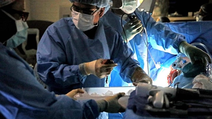 A surgeon removes a kidney from an organ donor for transplant at SSM Health Saint Louis University Hospital. A new cure for h