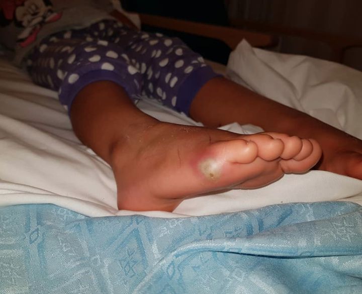 Sienna’s mother, Jodie Thomas, shared a photo of her daughter’s infected foot to Facebook.