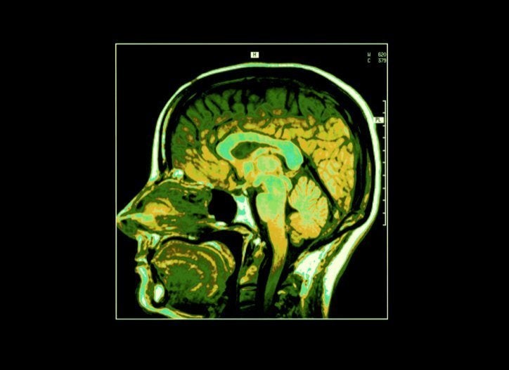 mindfulness brain mri