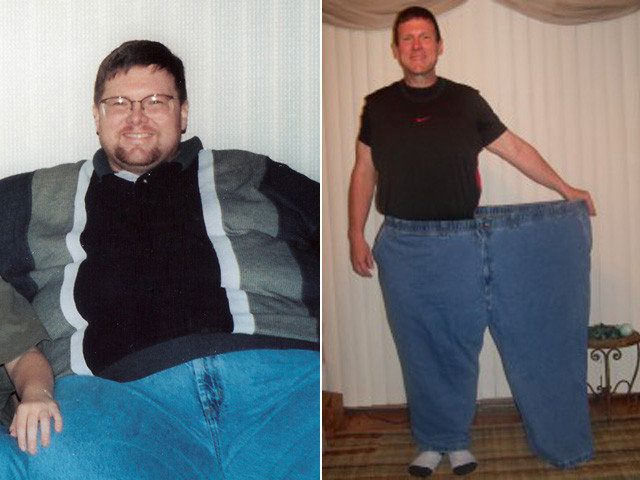 I Lost Weight: Jerome Biggars Lost 300 Pounds On A Medically-Supervised ...