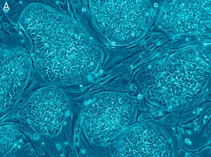 File:Human_embryonic_stem_cells.png licensed with Cc-by-2.5, PLoS 2006-12-04T09:53:19Z Ayacop 1010x1899 (2765117 Bytes. Embryonic Stem Cells ... 