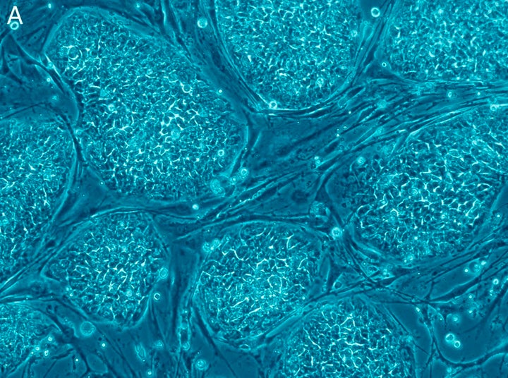 File:Human_embryonic_stem_cells.png licensed with Cc-by-2.5, PLoS 2006-12-04T09:53:19Z Ayacop 1010x1899 (2765117 Bytes. Embryonic Stem Cells ... 