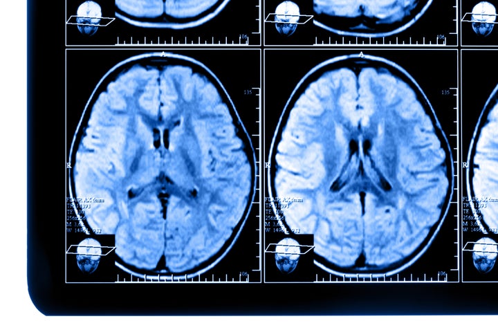 x ray image of the brain...