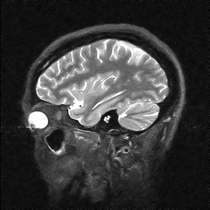 magnetic resonance image of the ...