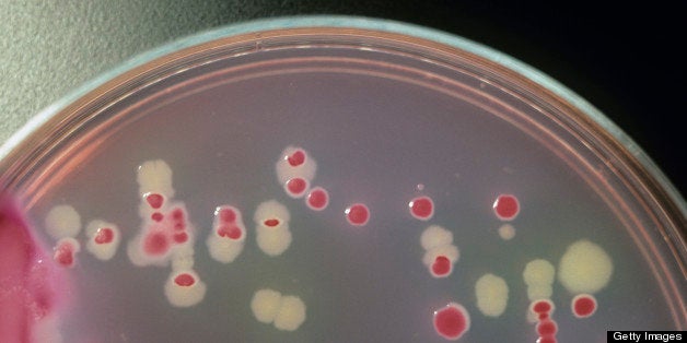 Salmonella typhimurium (white) and E. coli (pink) colonies on agar in a petri dish, with a pencil for scale.