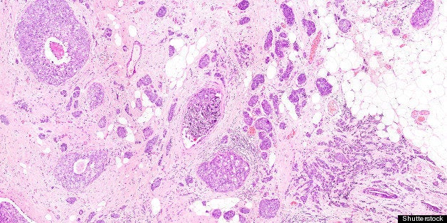 microscope picture of breast...