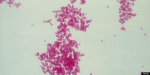 Light micrograph of Bordetella pertussis, a Gram-negative, aerobic coccobacillus, is the causative agent of pertussis or whooping cough. Magnification: 280x.
