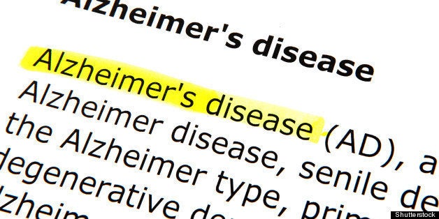 alzheimer's disease