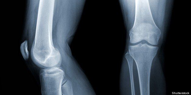 x ray of a regular knee joint...