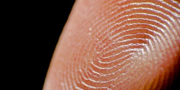 why-some-people-don-t-have-fingerprints-huffpost-life