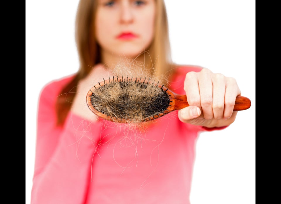 Excessive hair loss