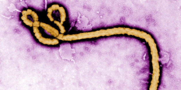 UNDATED: In this handout from the Center for Disease Control (CDC), a colorized transmission electron micrograph (TEM) of a Ebola virus virion is seen. As the Ebola virus continues to spread across parts of Africa, a second doctor infected with the disease has arrived in the U.S. for treatment. (Photo by Center for Disease Control (CDC) via Getty Images)