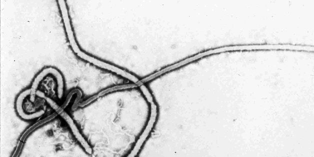 The Ebola Virus is shown in this undated electron micrograph photo provided by the Centers for Disease Control and Prevention in Atlanta, Ga., Thursday, May 11, 1995. The CDC has determined that a strain of the virus is responsible for deaths in Kikwit, Zaire, and has sent a team of researchers to the African country to investigate. (AP Photo)