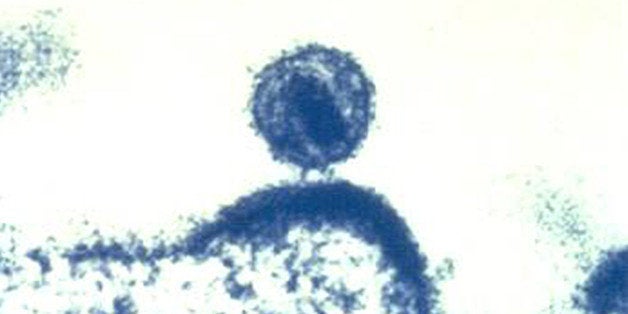 This Feb. 3, 2012 microscope image made available by the National Institute of Allergy and Infectious Diseases shows a human immunodeficiency virus (HIV) budding out of a human immune cell, which the virus infects and uses to replicate. Doctors may one day be able to control a patientᅢ까タᅡルs HIV infection in a new way: injecting swarms of germ-fighting antibodies, two new studies suggest. Reports by Dr. Dan Barouch of Harvard and the Beth Israel Deaconess Medical Center in Boston and the National Institutes of Health were published Wednesday, Oct. 30, 2013 in the journal Nature. (AP Photo/NIAID)