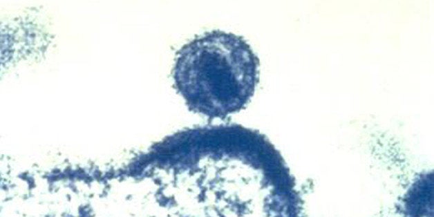 This Feb. 3, 2012 microscope image made available by the National Institute of Allergy and Infectious Diseases shows a human immunodeficiency virus (HIV) budding out of a human immune cell, which the virus infects and uses to replicate. Doctors may one day be able to control a patientￃﾢￂﾀￂﾙs HIV infection in a new way: injecting swarms of germ-fighting antibodies, two new studies suggest. Reports by Dr. Dan Barouch of Harvard and the Beth Israel Deaconess Medical Center in Boston and the National Institutes of Health were published Wednesday, Oct. 30, 2013 in the journal Nature. (AP Photo/NIAID)