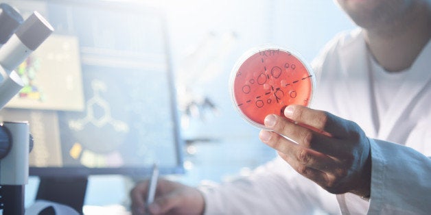 A scientist examining a petri dish containing bacterial cultures