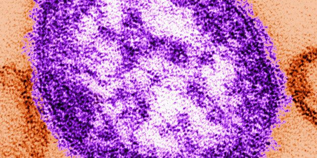 This undated image made available by the Centers for Disease Control and Prevention on Feb. 4, 2015 shows an electron microscope image of a measles virus particle, center. Measles is considered one of the most infectious diseases known. The virus is spread through the air when someone infected coughs or sneezes. (AP Photo/Centers for Disease Control and Prevention, Cynthia Goldsmith)
