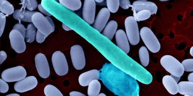 Clostridium difficile spores surrounding a long Cl. difficile bacterium. The spores were purified but occasionally individual bacteria were found in the preparation. As a sporulating bacterium, Cl. difficile is a dangerous pathogen, particularly in hospita