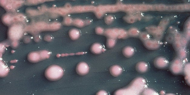In this undated photo provided by the Centers for Disease Control and Prevention is one form of CRE bacteria, sometimes called ᅢ까タᅡワnightmare bacteria.ᅢ까タᅡン CRE bacteria is blamed for 600 deaths each year, and can withstand treatment from virtually every type of antibiotic. (AP Photo/Centers for Disease Control and Prevention)