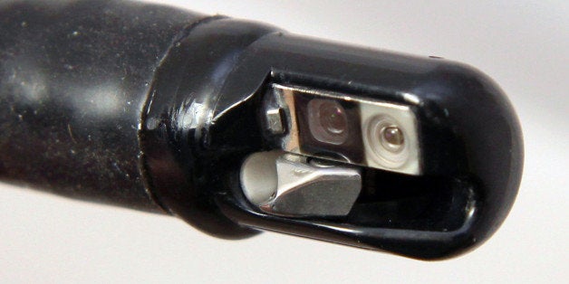 FILE - This undated file photo provided by the U.S. Food and Drug Administration shows the tip of an endoscopic retrograde cholangiopancreatography (ERCP) duodenoscope, attached to a long tube, not shown. Cedars-Sinai Medical Center said on Wednesday, March 4, 2015, that four patients have been infected with a superbug linked to a contaminated medical scope. Itᅢ까タᅡルs the second Los Angeles hospital to report infections from a superbug known as CRE. (AP Photo/U.S. Food and Drug Administration, File)