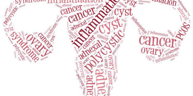 Word cloud illustration ovarian diseases related