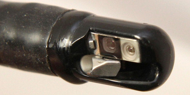 This undated photo provided by the U.S. Food and Drug Administration shows the tip of an endoscopic retrograde cholangiopancreatography (ERCP) duodenoscope, attached to a long tube, not shown. A "superbug" outbreak suspected in the deaths of two Los Angeles hospital patients is raising disturbing questions about the design of a hard-to-clean medical instrument used on more than half a million people in the U.S. every year. At least seven people ￃﾢￂﾀￂﾔ two of whom died ￃﾢￂﾀￂﾔ have been infected with a potentially lethal, antibiotic-resistant strain of bacteria after undergoing endoscopic procedures at Ronald Reagan UCLA Medical Center between October and January. More than 170 other patients may also have been exposed, university officials said. (AP Photo/U.S. Food and Drug Administration)