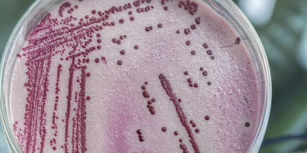 Petri dish full of pink and red microbacterias