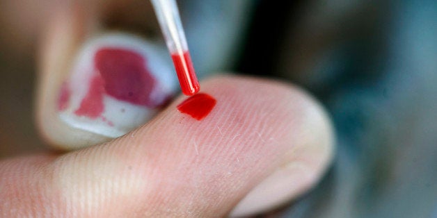 A person does a blood test at a roadside AIDS testing table in Langa, a suburb of Cape Town during the International AIDS Day on December 01, 2010. A million people are now receiving anti-AIDS drugs in South Africa, a country with the world's heaviest HIV infections, Deputy President Kgalema Motlanthe said. South Africa has 5.6 million people who are HIV-positive out of a 50-million population, according to UN estimates. AFP PHOTO/RODGER BOSCH (Photo credit should read RODGER BOSCH/AFP/Getty Images)