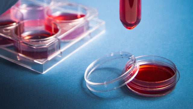 biochemistry of blood tests....