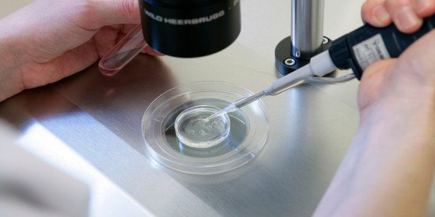 In vitro fertilization, Reproductive biology laboratory University hospital of Rouen, France. (Photo by: Media for Medical/UIG via Getty Images)