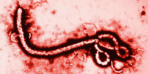 Ebola Virus at 108,000 Magnification