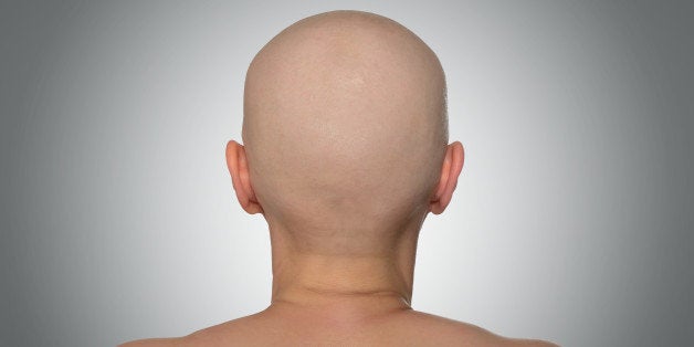 bald head rear view. file...