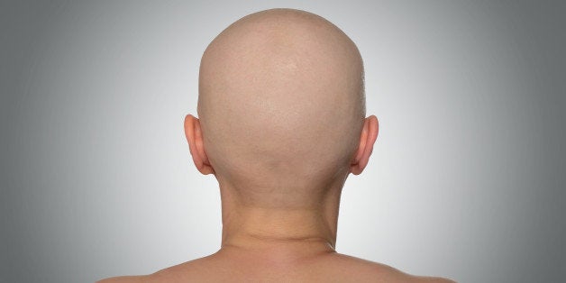 bald head rear view. file...