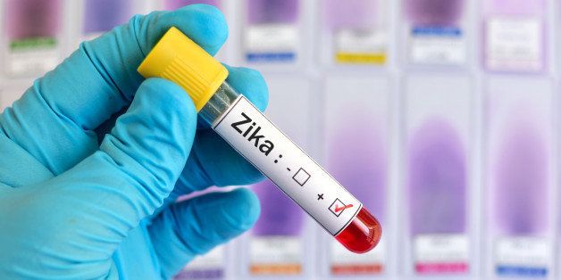 Blood sample positive with Zika virus