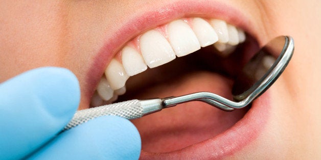 Close-up of female with open mouth during oral checkup at the dentist's Note to inspector: the image is pre-Sept 1 2009