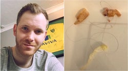 Deliveroo Tells Customer Thick Human Hairs In His Food Are 'Matter Of Personal