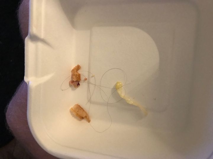 The hair that Darren Wood found in his food. Deliveroo later said the find was 'a matter of personal taste'.