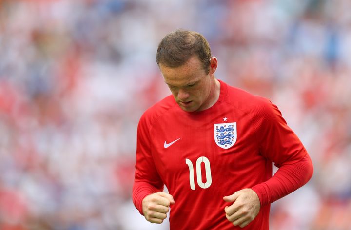 Wayne Rooney was well known for having thin hair
