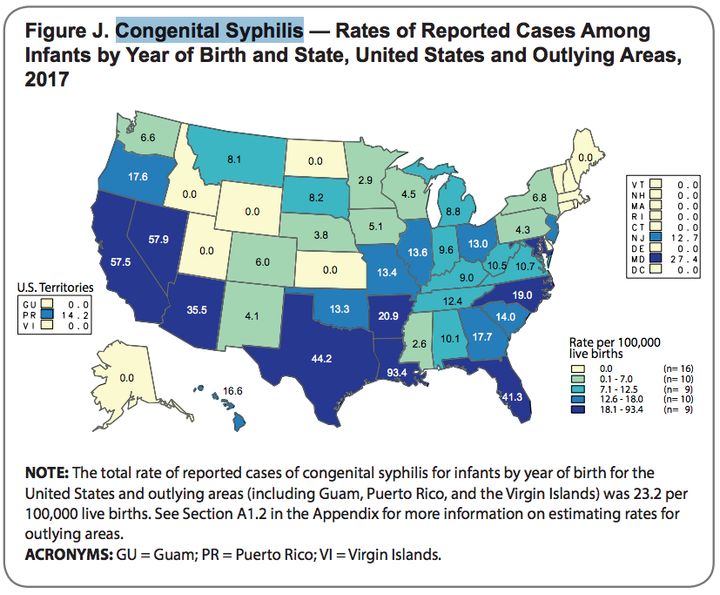 Western and Southern states had the highest rates of congenital syphilis in the U.S.