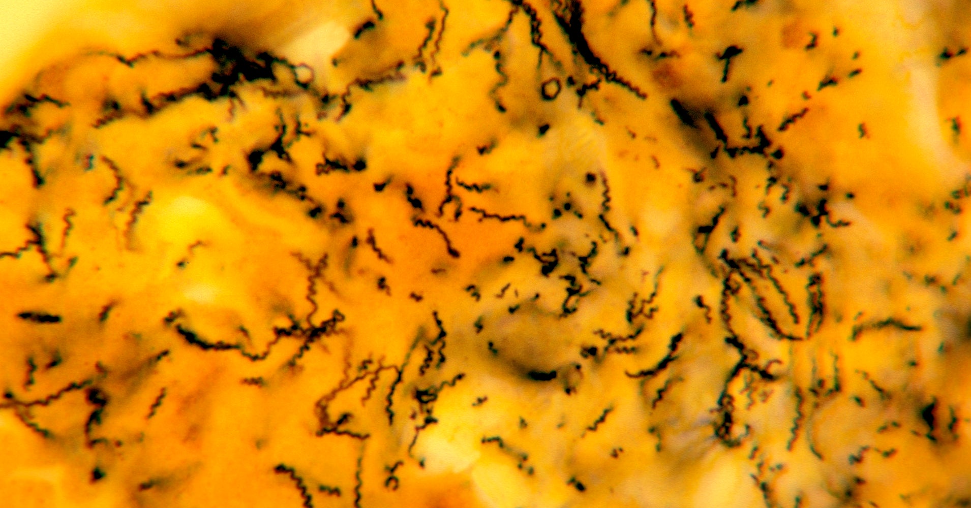 Метод серебрения по морозову. Импрегнация серебром микробиология. Метод серебрения по морозову. Метод серебрения по морозову. Серебрение по морозову трепонема.