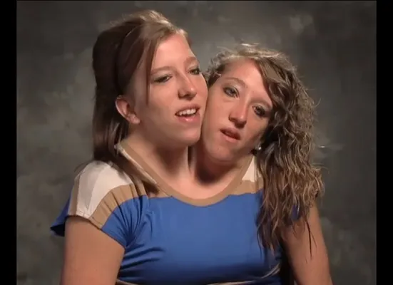 Conjoined twins Abigail and Brittany Hensel take in the sights of London in  latest episode of reality show