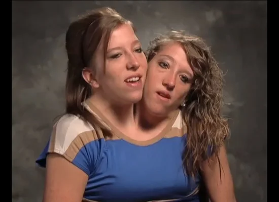 Conjoined twins Abigail and Brittany Hensel take in the sights of London in latest episode of reality show
