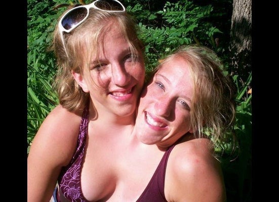 Amazing story of conjoined twins Abigail and Brittany Hensel