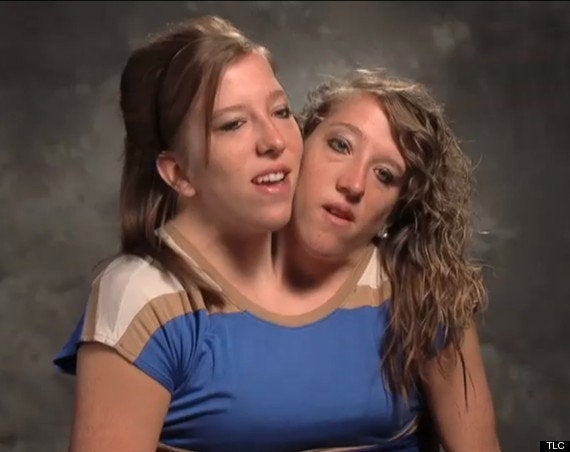 Abby Hensel, Brittany Hensel Reality Show: Conjoined Twins Star In TLC's ' Abby And Brittany' (VIDEO)